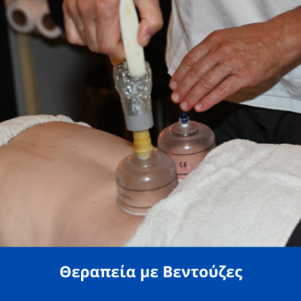 therapeia me ventouzes spineworks thessaloniki