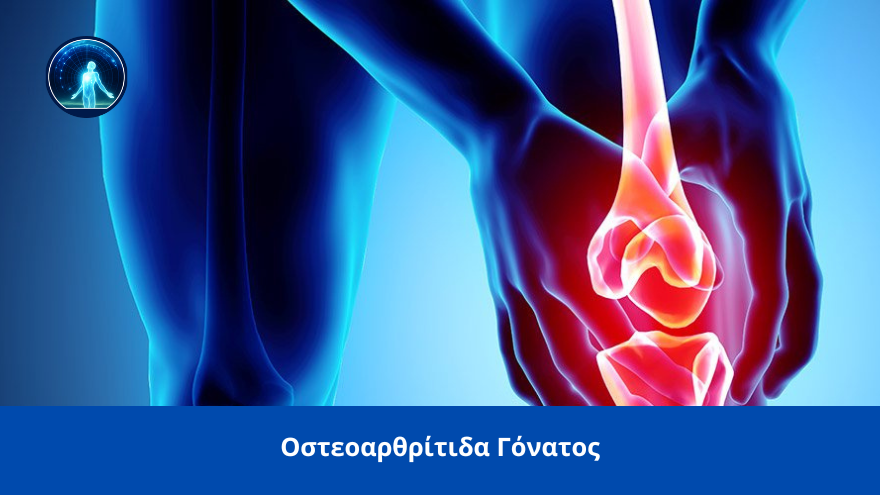 Spineworks osteoarthritida gonatos