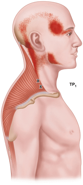 ponos ston ayxena kai ponokefalos spineworks