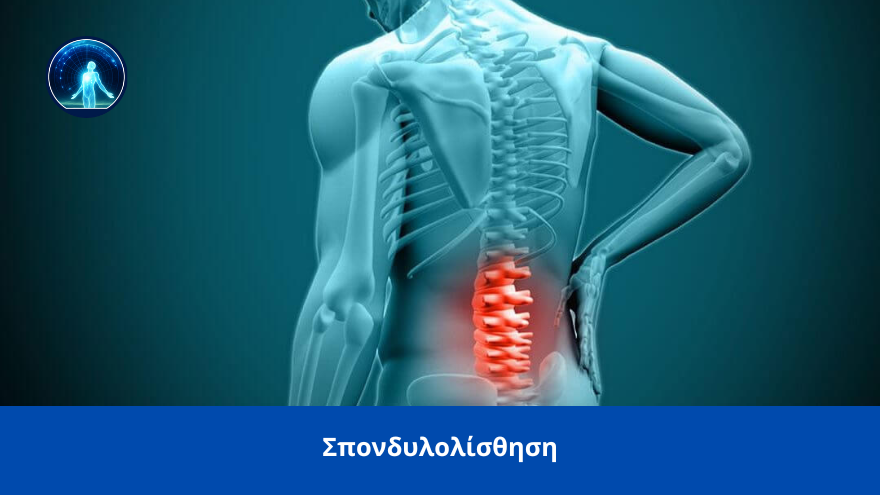 spondylolisthisi spineworks