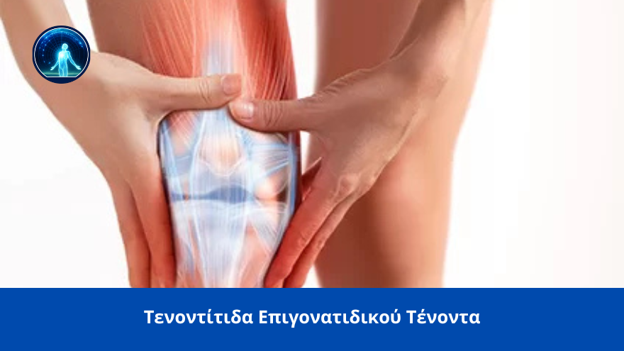 tenontitida epigonatidikou spineworks