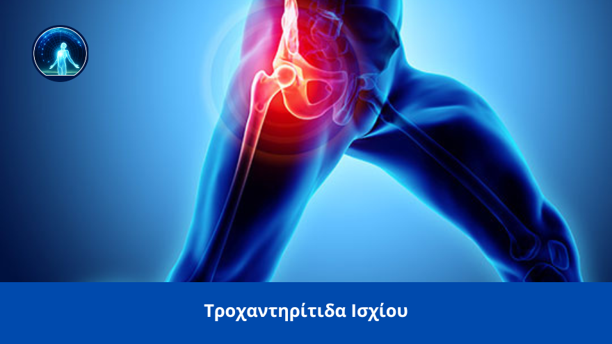 trohantiritida isxiou spineworks