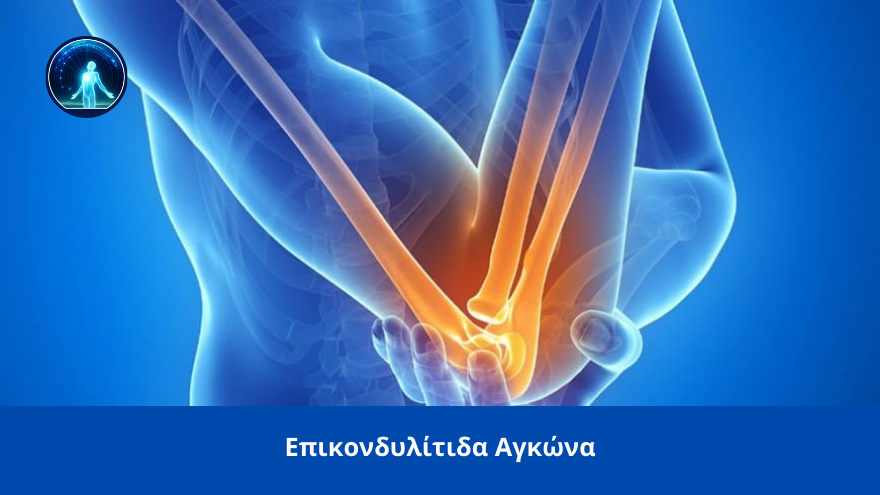 Spineworks epikondilitida agkona