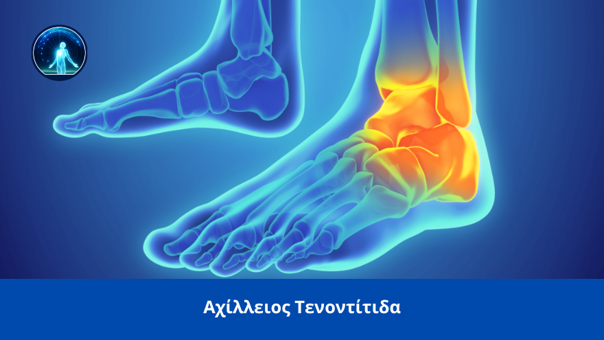 axilleios tenontitida spineworks