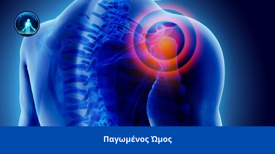 pagomenos omos spineworks